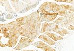 PPP1R15B Antibody in Immunohistochemistry (Paraffin) (IHC (P))