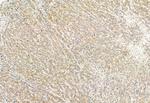 PPP1R15B Antibody in Immunohistochemistry (Paraffin) (IHC (P))