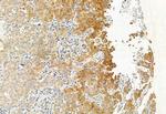 PPP1R15B Antibody in Immunohistochemistry (Paraffin) (IHC (P))