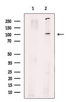 PPP1R15B Antibody in Western Blot (WB)