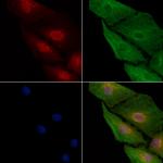 COMMD1 Antibody in Immunocytochemistry (ICC/IF)