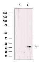 COMMD1 Antibody in Western Blot (WB)