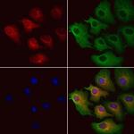 MCD Antibody in Immunocytochemistry (ICC/IF)