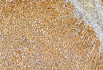 MCD Antibody in Immunohistochemistry (Paraffin) (IHC (P))