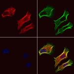 PIEZO1 Antibody in Immunocytochemistry (ICC/IF)