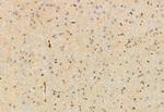 PIEZO1 Antibody in Immunohistochemistry (Paraffin) (IHC (P))