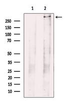 PIEZO1 Antibody in Western Blot (WB)