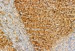 AP3B1 Antibody in Immunohistochemistry (Paraffin) (IHC (P))