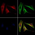 RDH10 Antibody in Immunocytochemistry (ICC/IF)