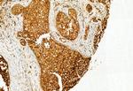 TCP-1 gamma Antibody in Immunohistochemistry (Paraffin) (IHC (P))