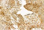 TCP-1 gamma Antibody in Immunohistochemistry (Paraffin) (IHC (P))