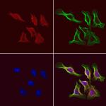 TCP-1 gamma Antibody in Immunocytochemistry (ICC/IF)