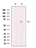 TCP-1 gamma Antibody in Western Blot (WB)