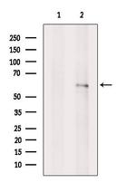 TCP-1 gamma Antibody in Western Blot (WB)