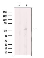 GluD1 Antibody in Western Blot (WB)