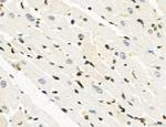 OGDH Antibody in Immunohistochemistry (Paraffin) (IHC (P))