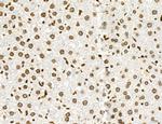 OGDH Antibody in Immunohistochemistry (Paraffin) (IHC (P))