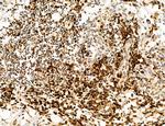 OGDH Antibody in Immunohistochemistry (Paraffin) (IHC (P))