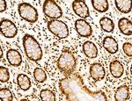 OGDH Antibody in Immunohistochemistry (Paraffin) (IHC (P))