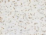 OGDH Antibody in Immunohistochemistry (Paraffin) (IHC (P))