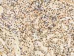 OGDH Antibody in Immunohistochemistry (Paraffin) (IHC (P))