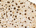 OGDH Antibody in Immunohistochemistry (Paraffin) (IHC (P))