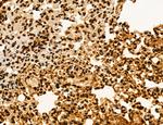 OGDH Antibody in Immunohistochemistry (Paraffin) (IHC (P))