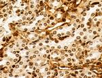 OGDH Antibody in Immunohistochemistry (Paraffin) (IHC (P))