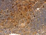 PPAT Antibody in Immunohistochemistry (Paraffin) (IHC (P))