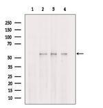 PPAT Antibody in Western Blot (WB)