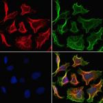 CHMP2A Antibody in Immunocytochemistry (ICC/IF)