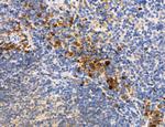 CHMP2A Antibody in Immunohistochemistry (Paraffin) (IHC (P))