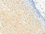 CHMP2A Antibody in Immunohistochemistry (Paraffin) (IHC (P))