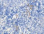 CHMP2A Antibody in Immunohistochemistry (Paraffin) (IHC (P))