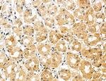 CHMP2A Antibody in Immunohistochemistry (Paraffin) (IHC (P))