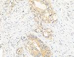 CHMP2A Antibody in Immunohistochemistry (Paraffin) (IHC (P))