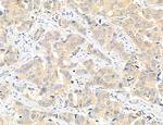 CHMP2A Antibody in Immunohistochemistry (Paraffin) (IHC (P))