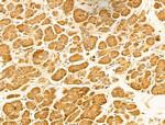 MICAL1 Antibody in Immunohistochemistry (Paraffin) (IHC (P))