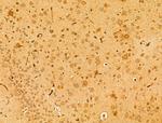 PEX16 Antibody in Immunohistochemistry (Paraffin) (IHC (P))