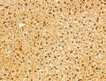 SYNPO2 Antibody in Immunohistochemistry (Paraffin) (IHC (P))