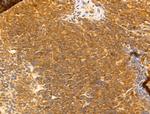 SYNPO2 Antibody in Immunohistochemistry (Paraffin) (IHC (P))