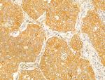 STX11 Antibody in Immunohistochemistry (Paraffin) (IHC (P))