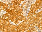 STX11 Antibody in Immunohistochemistry (Paraffin) (IHC (P))