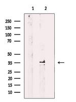 STX11 Antibody in Western Blot (WB)