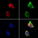 TAF12 Antibody in Immunocytochemistry (ICC/IF)