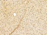 TAF12 Antibody in Immunohistochemistry (Paraffin) (IHC (P))