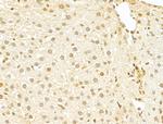 TAF12 Antibody in Immunohistochemistry (Paraffin) (IHC (P))