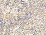 TAF12 Antibody in Immunohistochemistry (Paraffin) (IHC (P))