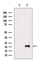 TAF12 Antibody in Western Blot (WB)