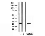 TAF12 Antibody in Western Blot (WB)